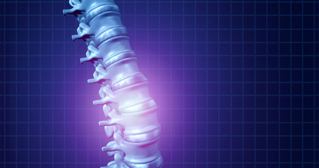 What Are Types of Spinal Cord Injuries From Car Accidents ...